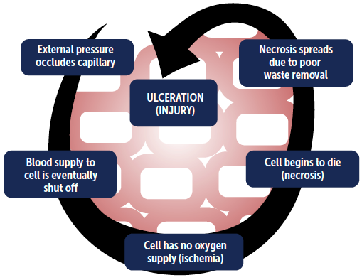 risk-of-ulcers-figure-1